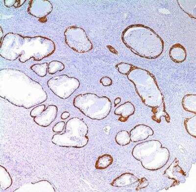 Immunohistochemistry-Paraffin: Cytokeratin 5 Antibody (EP1601Y) [NB110-56916]