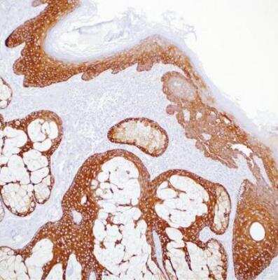 Immunohistochemistry-Paraffin: Cytokeratin 5 Antibody (EP1601Y) [NB110-56916]