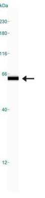 Simple Western: Cytokeratin 5 Antibody (EP1601Y) [NB110-56916]