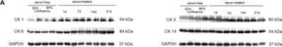 Western Blot: Cytokeratin 5 Antibody (EP1601Y) [NB110-56916]