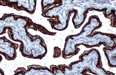 Immunohistochemistry-Paraffin: Cytokeratin 5 Antibody (GT1486) [NBP3-13606]