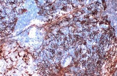 Immunohistochemistry-Paraffin: Cytokeratin 5 Antibody (GT1486) [NBP3-13606]