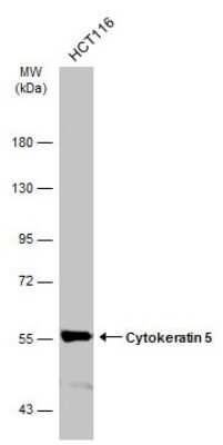 Western Blot: Cytokeratin 5 Antibody (GT1486) [NBP3-13606]