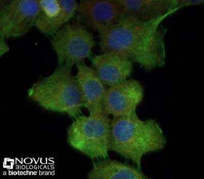 Immunocytochemistry/ Immunofluorescence: Cytokeratin 5 Antibody - BSA Free [NBP2-61931]