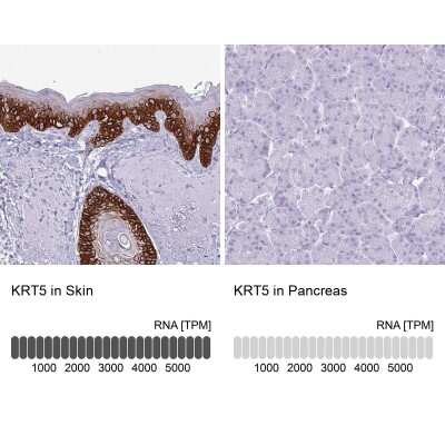 Immunohistochemistry-Paraffin: Cytokeratin 5 Antibody [NBP2-32470]