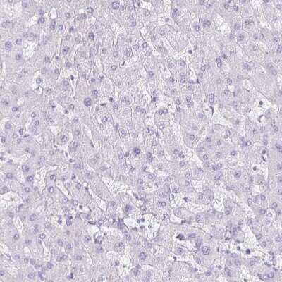 Immunohistochemistry-Paraffin: Cytokeratin 5 Antibody [NBP2-32470]