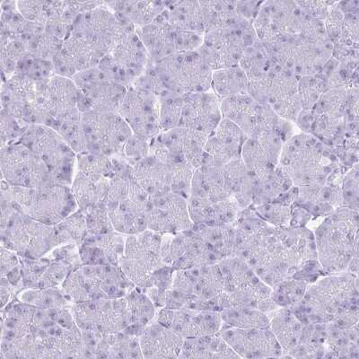 Immunohistochemistry-Paraffin: Cytokeratin 5 Antibody [NBP2-32470]