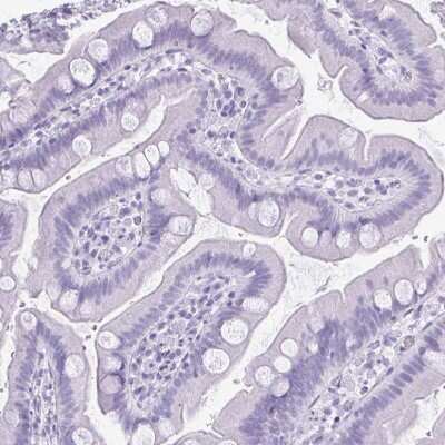 Immunohistochemistry-Paraffin: Cytokeratin 5 Antibody [NBP2-32470]