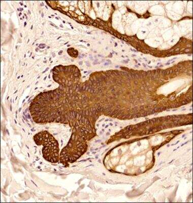 Immunohistochemistry-Paraffin: Cytokeratin 5 Antibody - BSA Free [NBP2-61931]