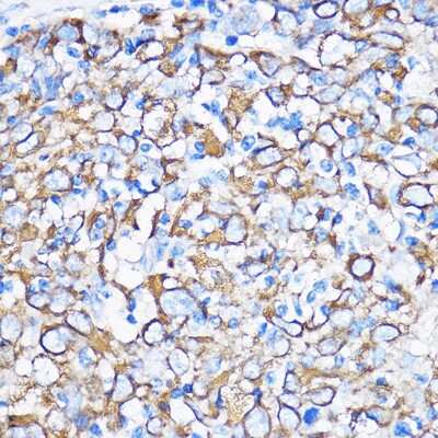 Immunohistochemistry-Paraffin: Cytokeratin 5 Antibody - Azide and BSA Free [NBP2-92884]
