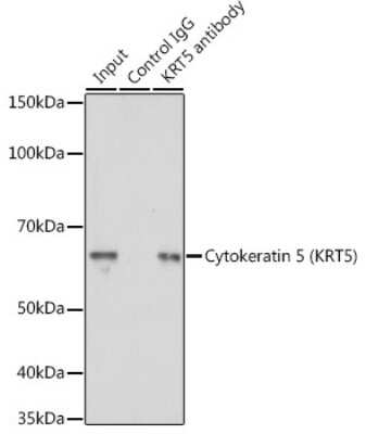 Immunoprecipitation: Cytokeratin 5 Antibody - Azide and BSA Free [NBP2-92884]