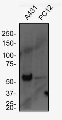 Western Blot: Cytokeratin 5 AntibodyBSA Free [NBP2-61931]