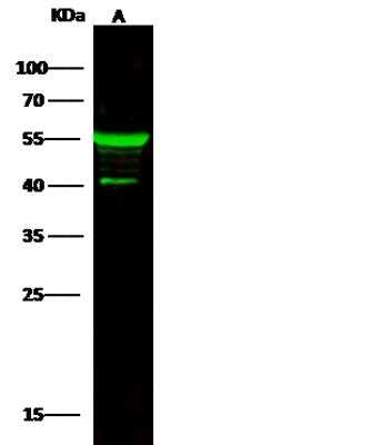 Western Blot: Cytokeratin 5 Antibody [NBP2-95276]