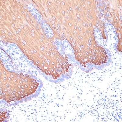 Immunohistochemistry-Paraffin: Cytokeratin 6 Antibody (3F7A1) [NBP3-15324]