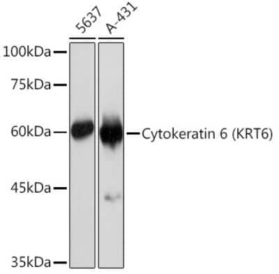 Western Blot: Cytokeratin 6 Antibody (3F7A1) [NBP3-15324]