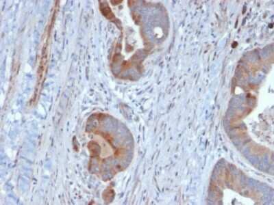 Immunohistochemistry-Paraffin: Cytokeratin 6 Antibody (KRT6B/2116) - Azide and BSA Free [NBP3-08612]