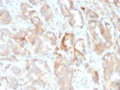 Immunohistochemistry-Paraffin: Cytokeratin 6 Antibody (KRT6B/2116) - Azide and BSA Free [NBP3-08612]