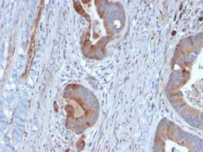 Immunohistochemistry-Paraffin: Cytokeratin 6 Antibody (KRT6B/2116) [NBP3-07798]