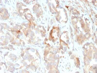 Immunohistochemistry-Paraffin: Cytokeratin 6 Antibody (KRT6B/2116) [NBP3-07798]