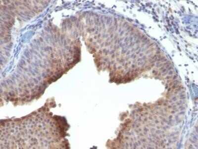 Immunohistochemistry-Paraffin: Cytokeratin 6 Antibody (LHK6 (same as LHK6B)) - Azide and BSA Free [NBP2-34669]