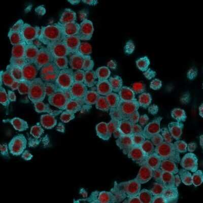 Immunocytochemistry/ Immunofluorescence: Cytokeratin 6 Antibody (SPM269) - Azide and BSA Free [NBP2-34406]