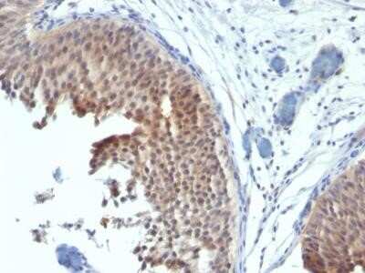 Immunohistochemistry-Paraffin: Cytokeratin 6 Antibody (SPM269) - Azide and BSA Free [NBP2-34406]
