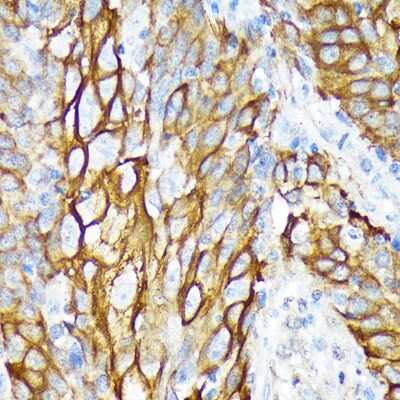Immunohistochemistry-Paraffin: Cytokeratin 6a Antibody (1T4Z8) [NBP3-16452]