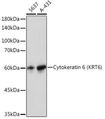 Western Blot: Cytokeratin 6a Antibody (1T4Z8) [NBP3-16452]