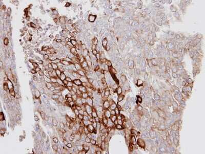 Immunohistochemistry-Paraffin: Cytokeratin 6a Antibody [NBP1-31443]
