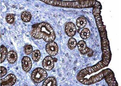 Immunohistochemistry-Paraffin: Cytokeratin 6a Antibody [NBP1-31443]