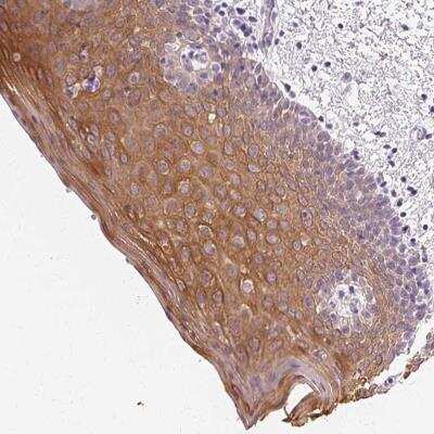 Immunohistochemistry-Paraffin: Cytokeratin 6a Antibody [NBP2-49325]