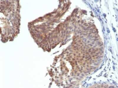 Immunohistochemistry-Paraffin: Cytokeratin 6a Antibody (KRT6/1702) [NBP2-53133]