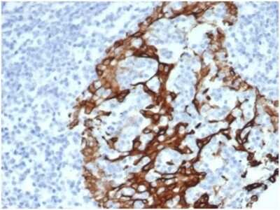 Immunohistochemistry-Paraffin: Cytokeratin 6a Antibody (KRT6/3997R) [NBP3-13955]