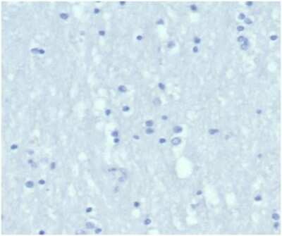 Immunohistochemistry-Paraffin: Cytokeratin 6a Antibody (KRT6/3997R) [NBP3-13955]