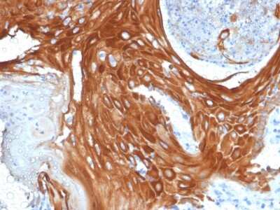 Immunohistochemistry-Paraffin: Cytokeratin 6a Antibody (KRT6A/2368) [NBP2-79719]