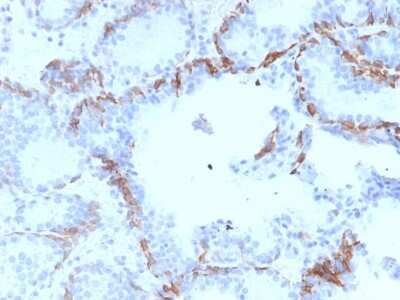 Immunohistochemistry-Paraffin: Cytokeratin 6a Antibody (KRT6A/2368) [NBP2-79719]