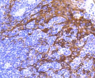 Immunohistochemistry-Paraffin: Cytokeratin 6a Antibody (SN71-07) [NBP2-67705]