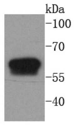 Western Blot: Cytokeratin 6a Antibody (SN71-07) [NBP2-67705]