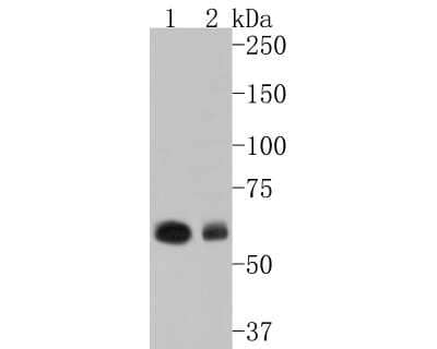 Western Blot: Cytokeratin 6a Antibody (SN71-07) [NBP2-67705]