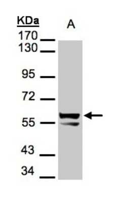 Western Blot: Cytokeratin 6a Antibody [NBP1-31443]