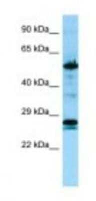 Western Blot: Cytokeratin 6a Antibody [NBP1-98517]