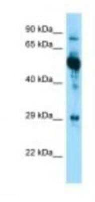 Western Blot: Cytokeratin 6a Antibody [NBP1-98557]