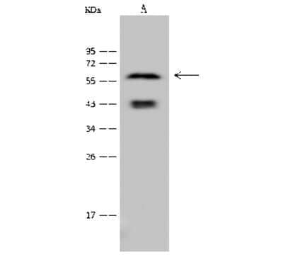 Western Blot: Cytokeratin 6a Antibody [NBP2-99480]