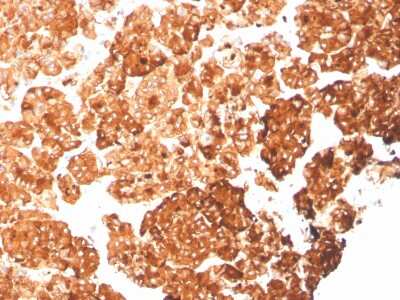 Immunohistochemistry-Paraffin: Cytokeratin 6a Antibody (rKRT6A/2100) - Azide and BSA Free [NBP3-08749]