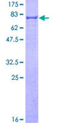 SDS-PAGE: Recombinant Human Cytokeratin 6a GST (N-Term) Protein [H00003853-P01]