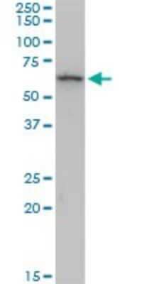 Western Blot: Cytokeratin 6b Antibody (1C12) [H00003854-M04]