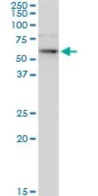 Western Blot: Cytokeratin 6b Antibody (1C4) [H00003854-M03]