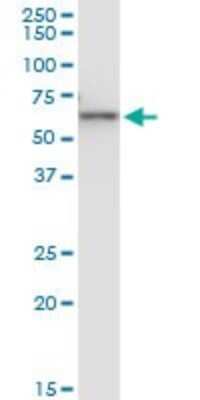 Western Blot: Cytokeratin 6b Antibody (3C4) [H00003854-M05]