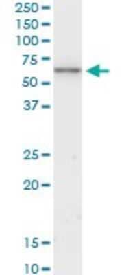 Western Blot: Cytokeratin 6b Antibody (4G9) [H00003854-M01]