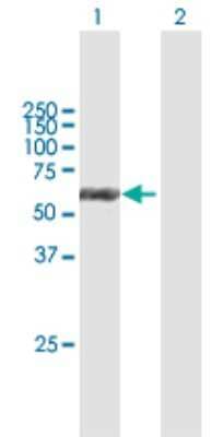 Western Blot: Cytokeratin 6b Antibody [H00003854-B01P]